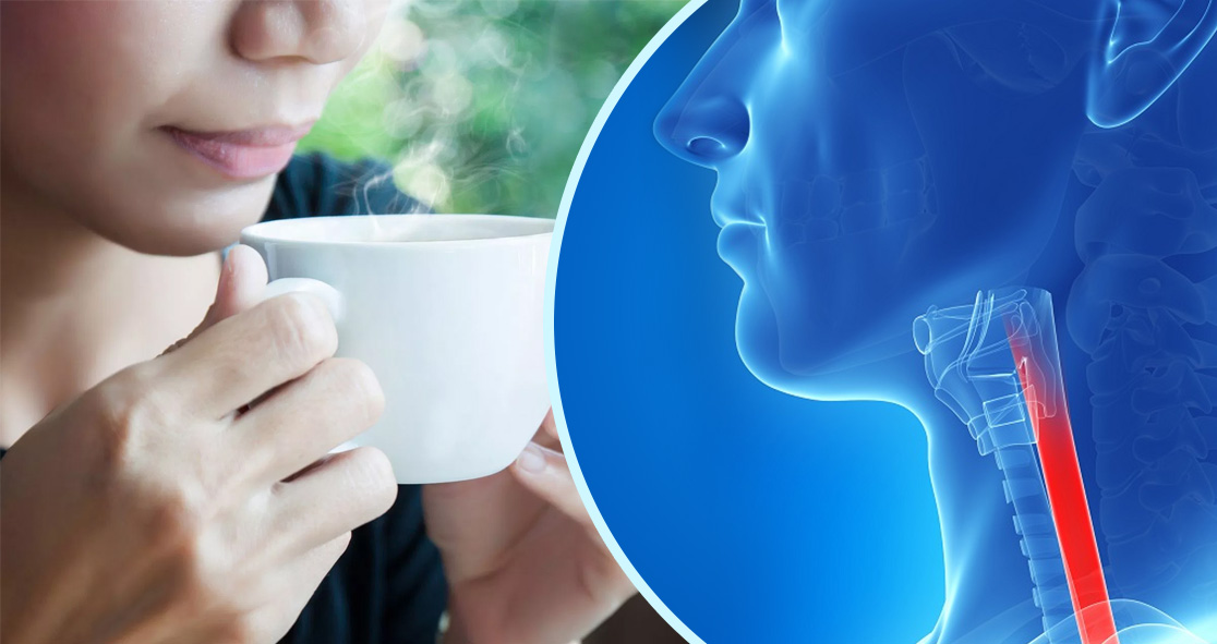 Does Drinking Hot Beverages Cause Esophageal Cancer