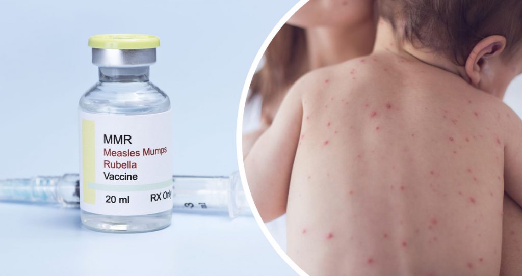 Maine Confirms Sixth Measles Case, Warns of Waterville Exposure