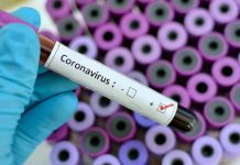 CDC Seeks Emergency Approval of Diagnostic Test from FDA to Detect 2019-nCoV