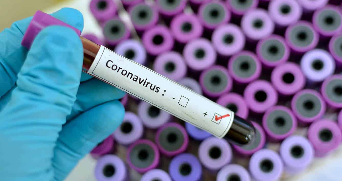 Cdc Seeks Emergency Approval Of Diagnostic Test From Fda To Detect