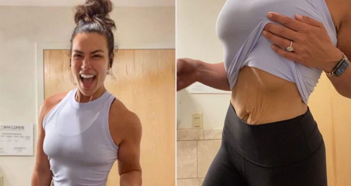 Erica Lugo Reveals She Will Be Getting Rid Of Her Loose Skin Surgically This Month