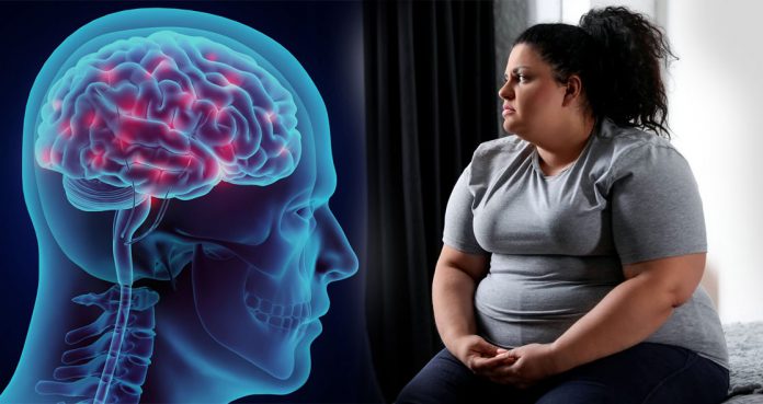 Your Brain Function Is Altered Before You Develop Obesity, Study Your-Brain-Function-Is-Altered-Before-You-Develop-Obesity,-Study