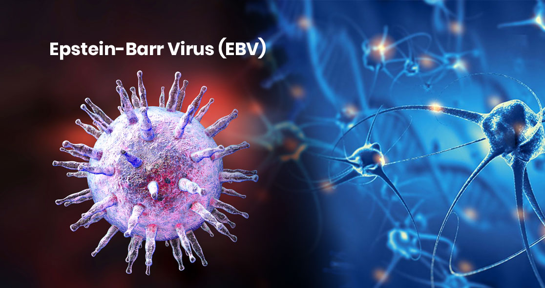 Epstein-Barr Virus Triggers Multiple Sclerosis, Confirms US Study ...