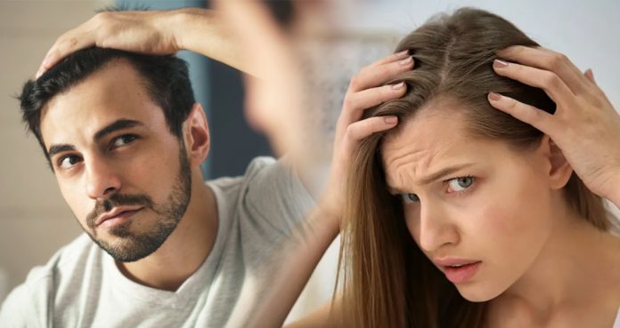 Are OTC Hair Loss Treatments Effective? Check What Experts Have To Say