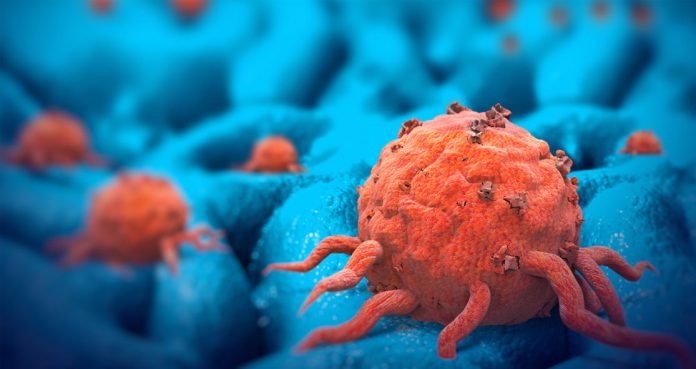 Researchers Discover Small Molecule That Inhibits Growth of Pancreatic Cancer Cells