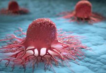 Nitrites-and-Nitrates-Intake-Linked-To-Increased-Cancer-Risk