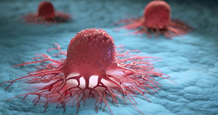 Nitrites and Nitrates Intake Linked To Increased Cancer Risk Nitrites-and-Nitrates-Intake-Linked-To-Increased-Cancer-Risk